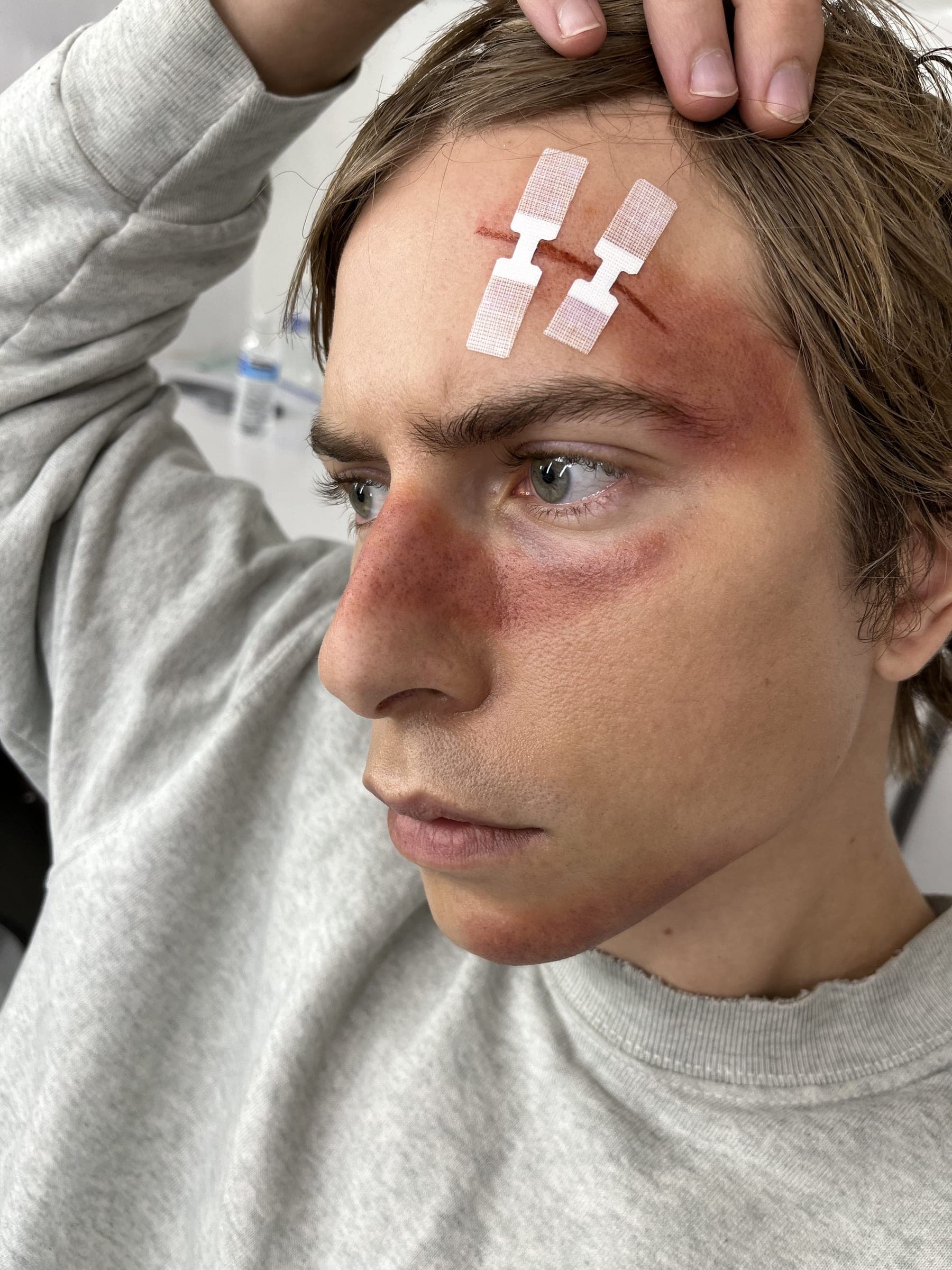 Bruising, character & wounds by Bailey DeLong